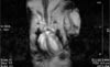 Heart imaging